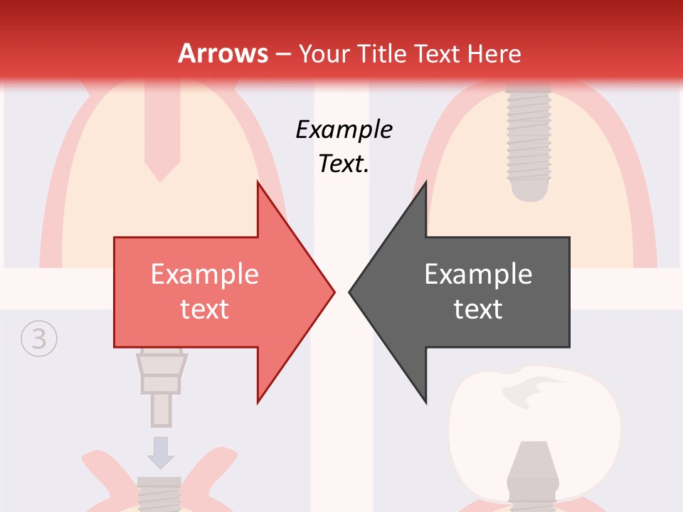 Modern Prosthesis Technology PowerPoint Template