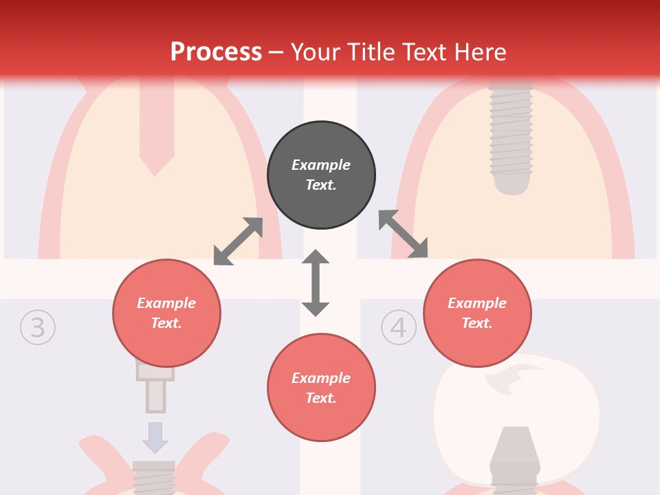 Modern Prosthesis Technology PowerPoint Template