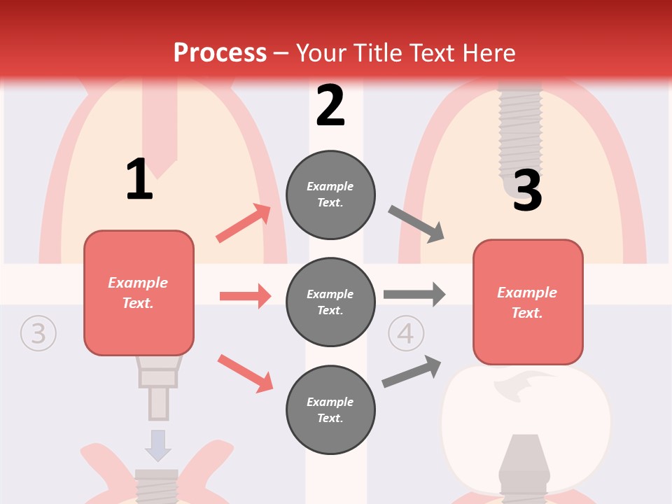 Modern Prosthesis Technology PowerPoint Template