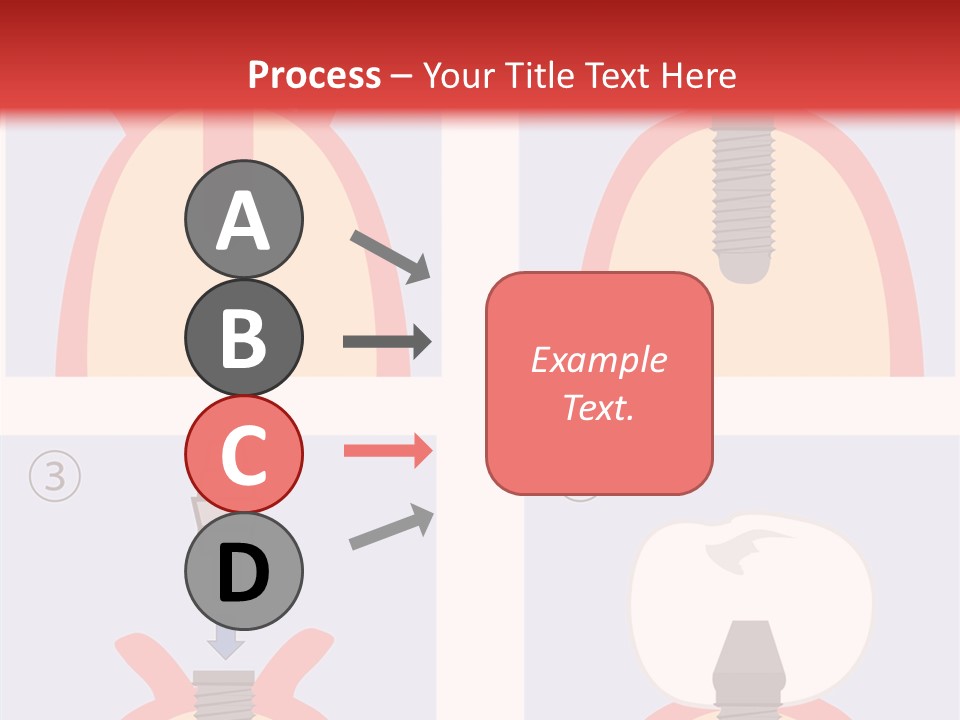Modern Prosthesis Technology PowerPoint Template