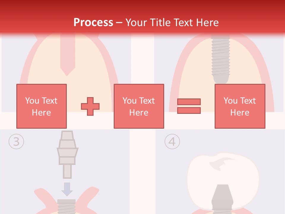 Modern Prosthesis Technology PowerPoint Template