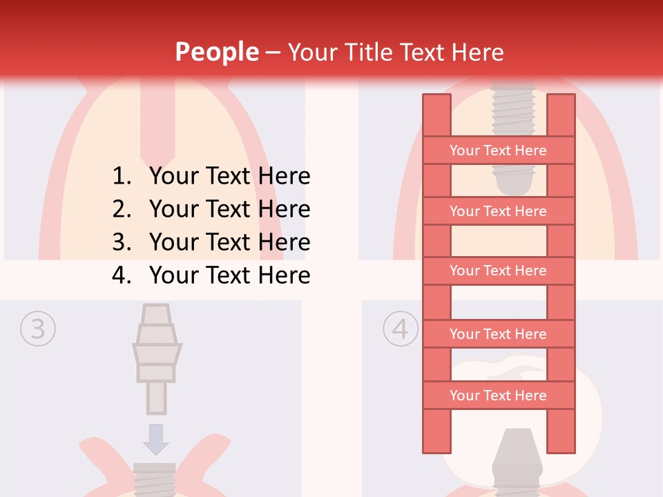 Modern Prosthesis Technology PowerPoint Template