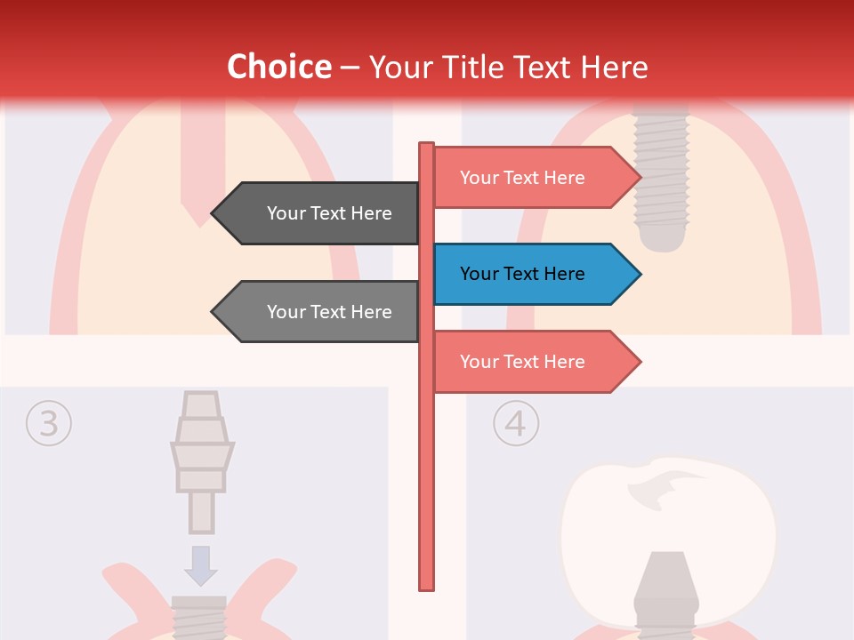 Modern Prosthesis Technology PowerPoint Template