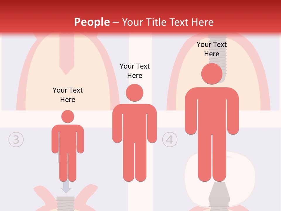 Modern Prosthesis Technology PowerPoint Template