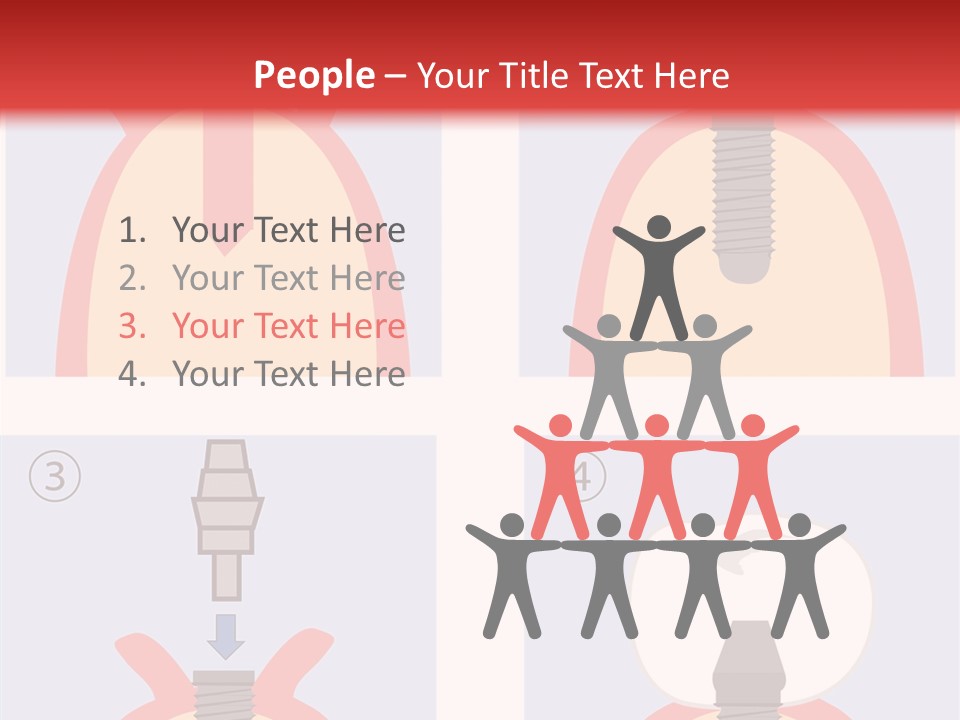 Modern Prosthesis Technology PowerPoint Template