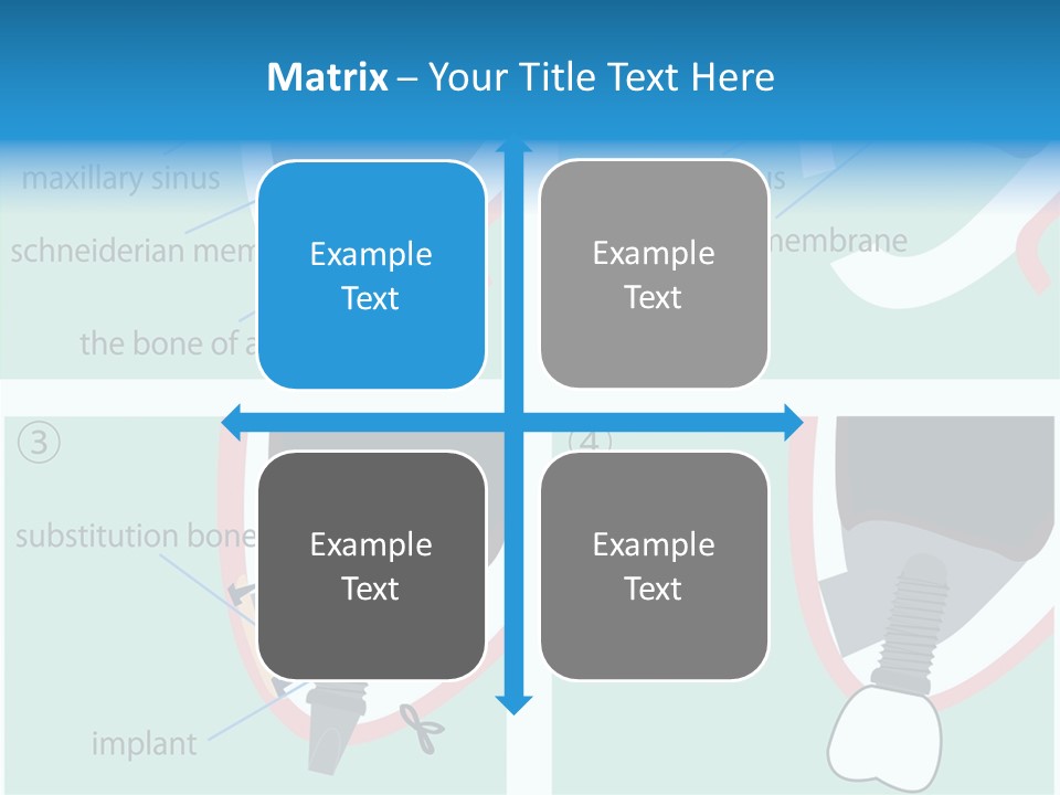 White Dentures Gingiva PowerPoint Template