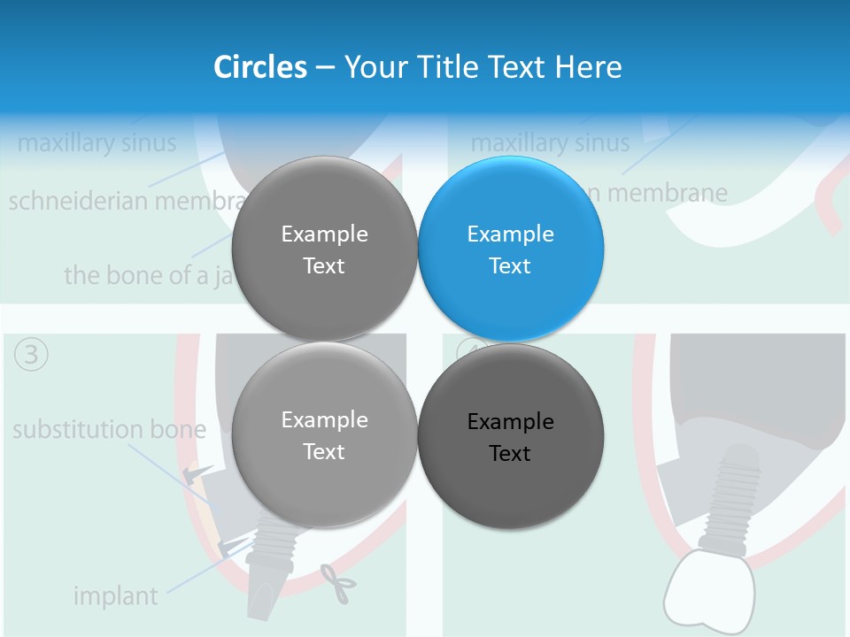 White Dentures Gingiva PowerPoint Template