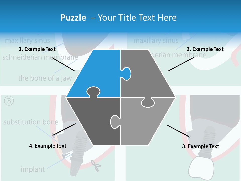 White Dentures Gingiva PowerPoint Template