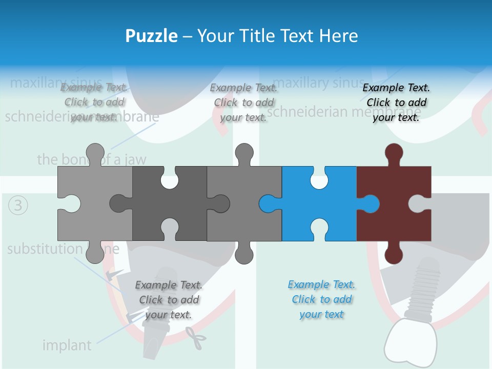 White Dentures Gingiva PowerPoint Template