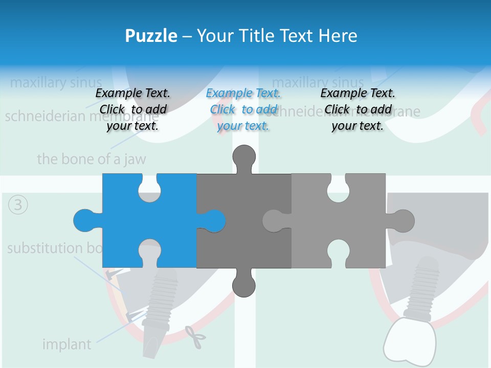 White Dentures Gingiva PowerPoint Template