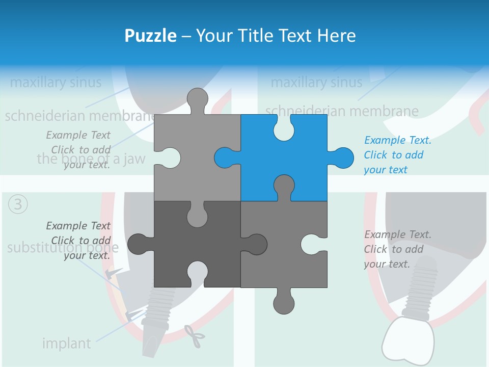 White Dentures Gingiva PowerPoint Template