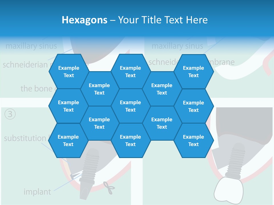 White Dentures Gingiva PowerPoint Template