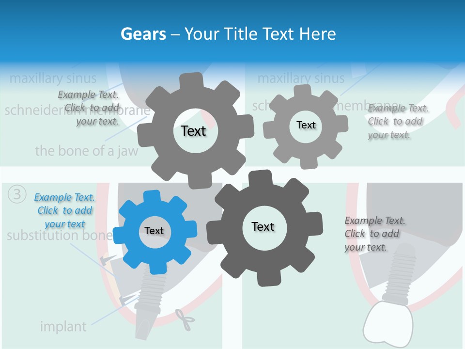White Dentures Gingiva PowerPoint Template