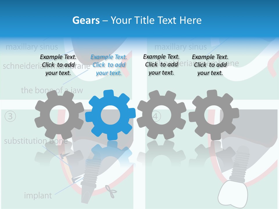 White Dentures Gingiva PowerPoint Template