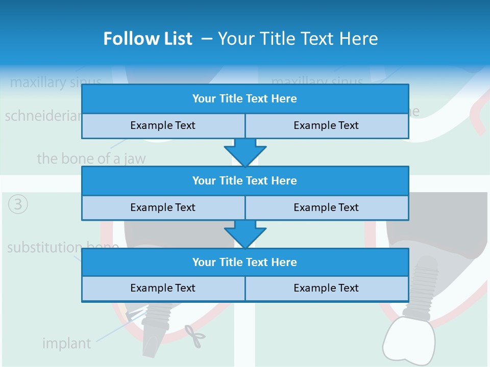 White Dentures Gingiva PowerPoint Template