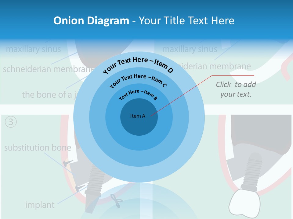 White Dentures Gingiva PowerPoint Template