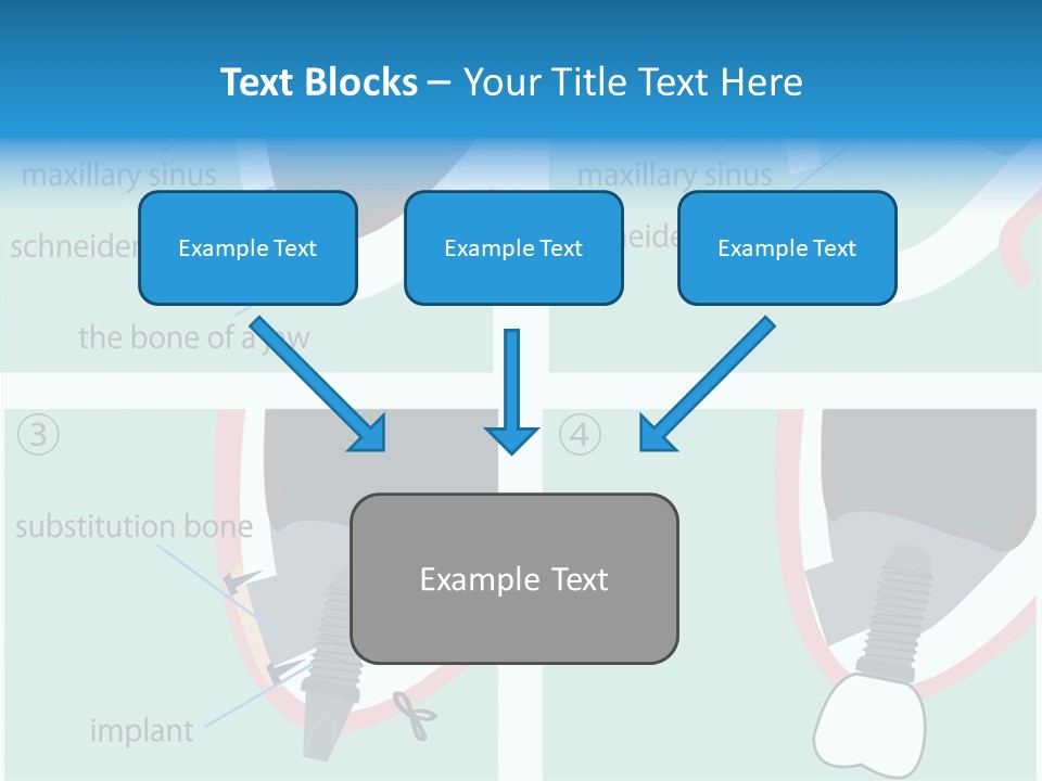 White Dentures Gingiva PowerPoint Template