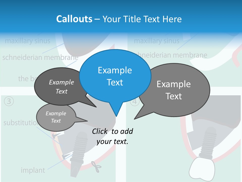 White Dentures Gingiva PowerPoint Template