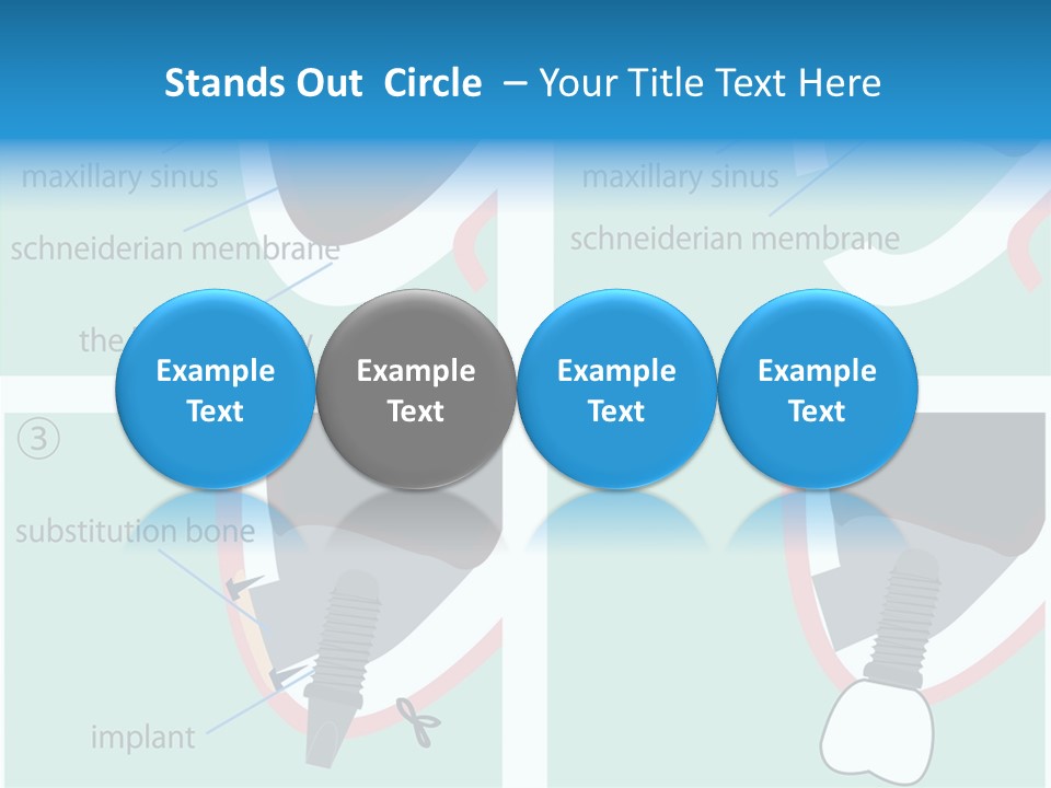 White Dentures Gingiva PowerPoint Template