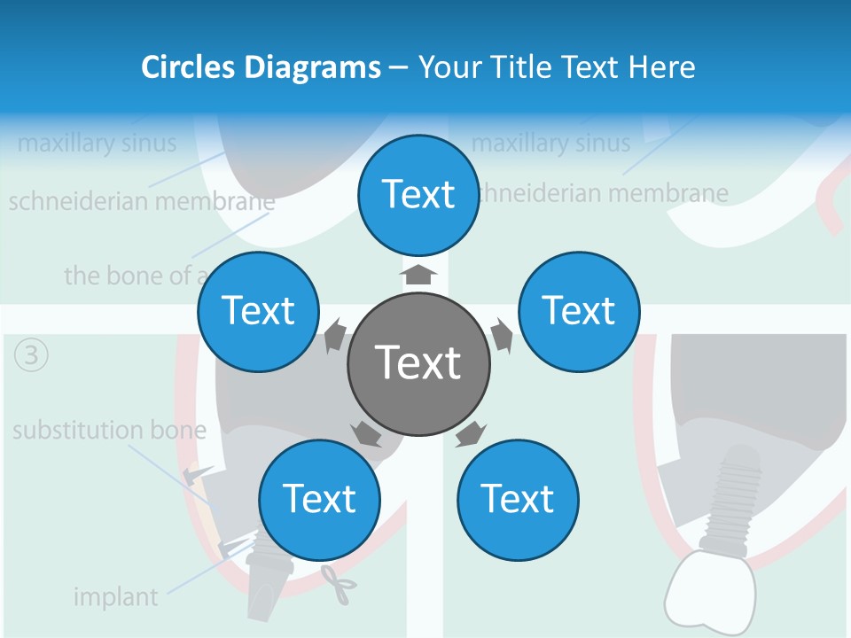 White Dentures Gingiva PowerPoint Template