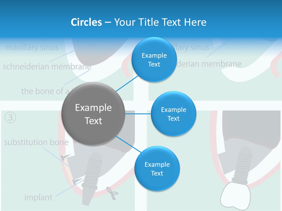 White Dentures Gingiva PowerPoint Template