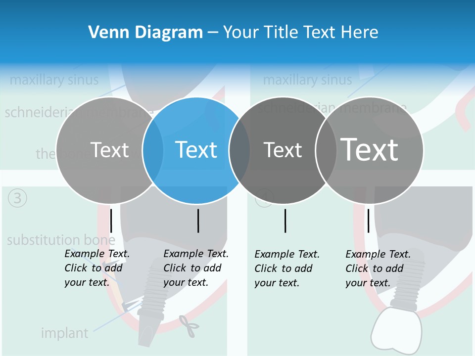White Dentures Gingiva PowerPoint Template