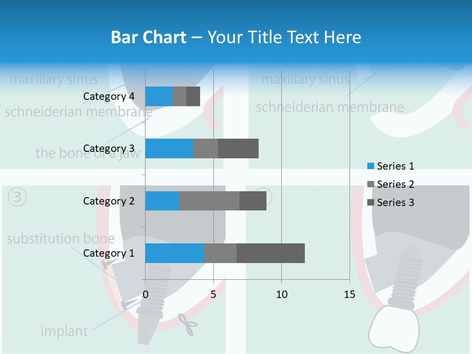 White Dentures Gingiva PowerPoint Template