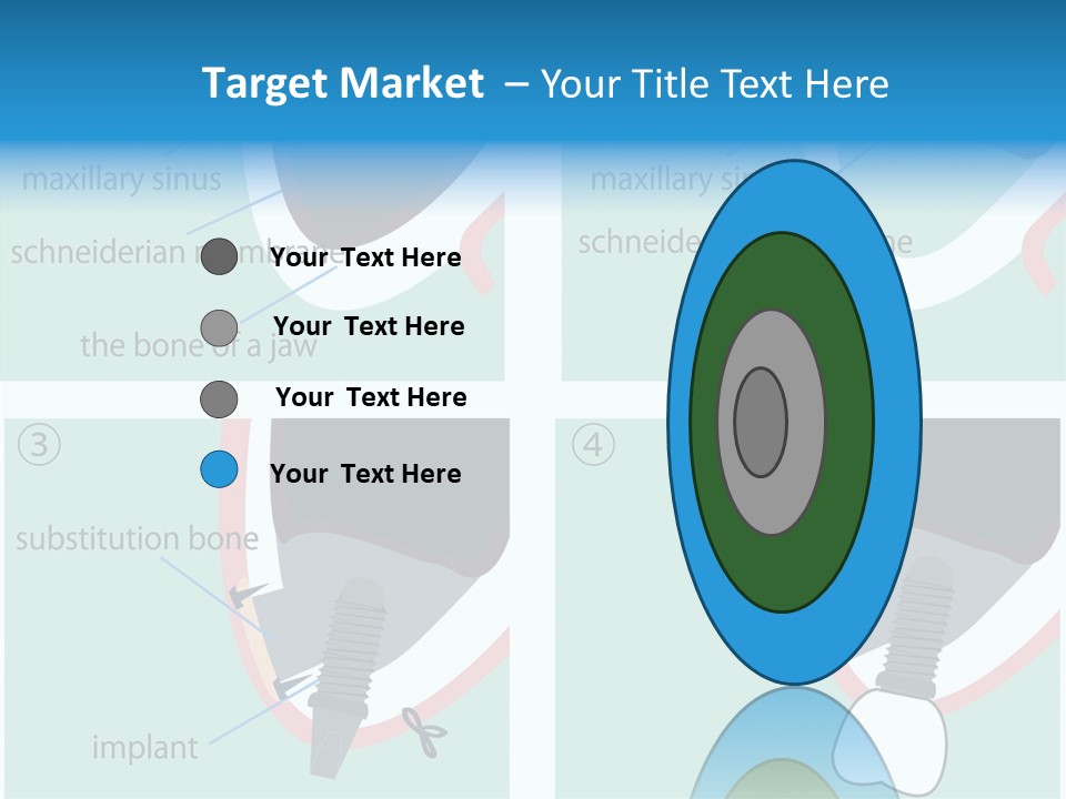 White Dentures Gingiva PowerPoint Template