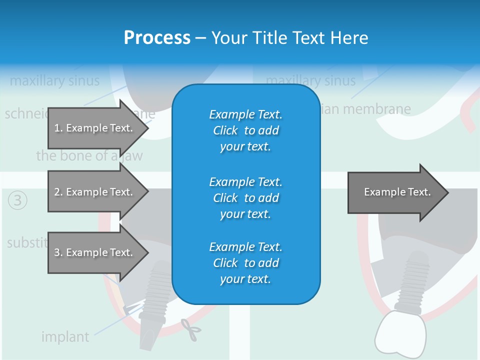 White Dentures Gingiva PowerPoint Template