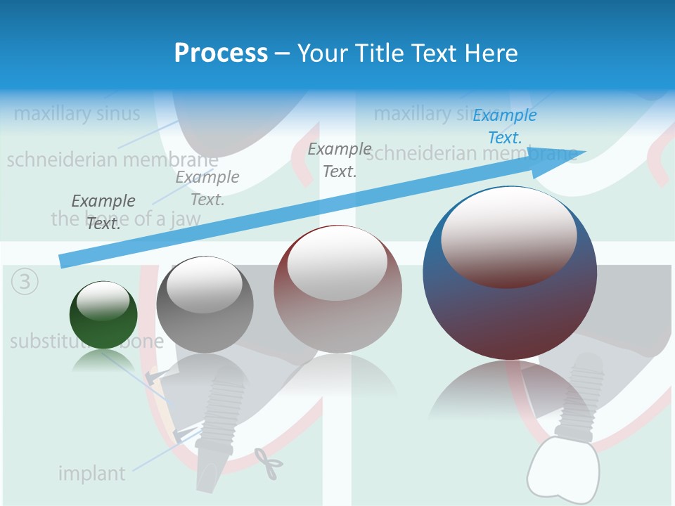 White Dentures Gingiva PowerPoint Template