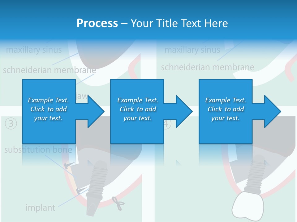White Dentures Gingiva PowerPoint Template
