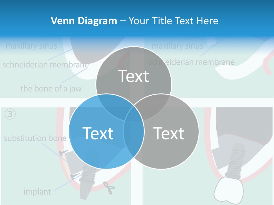White Dentures Gingiva PowerPoint Template