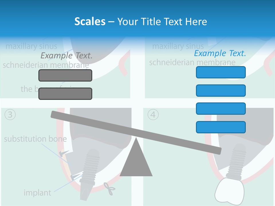 White Dentures Gingiva PowerPoint Template