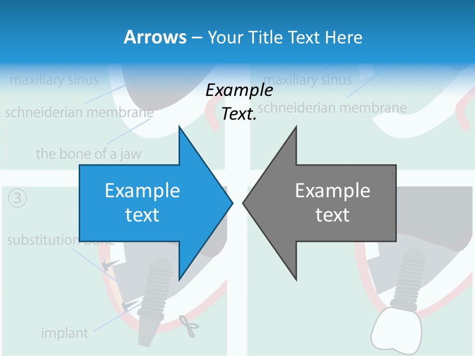 White Dentures Gingiva PowerPoint Template