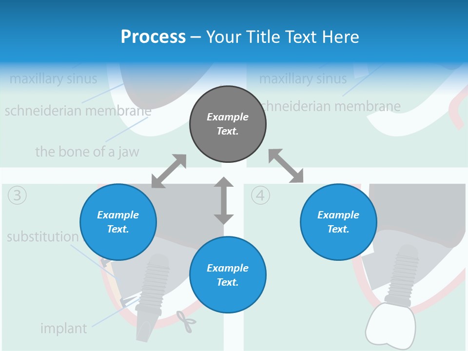 White Dentures Gingiva PowerPoint Template