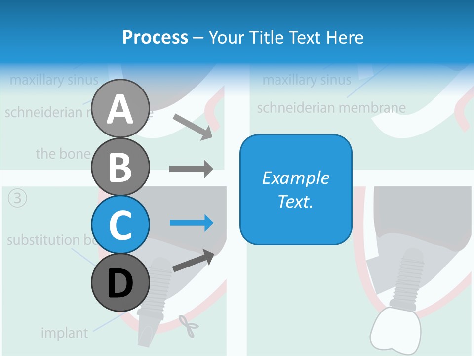 White Dentures Gingiva PowerPoint Template