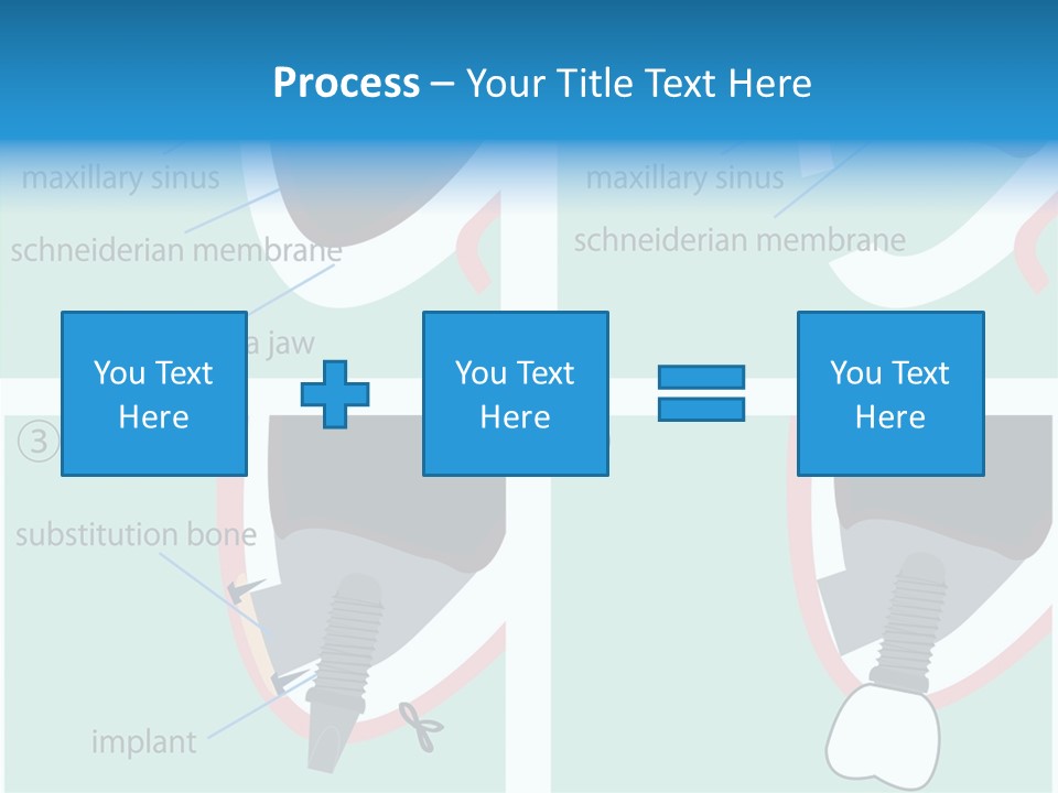 White Dentures Gingiva PowerPoint Template