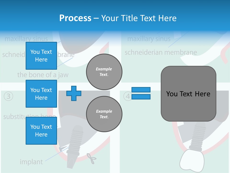 White Dentures Gingiva PowerPoint Template