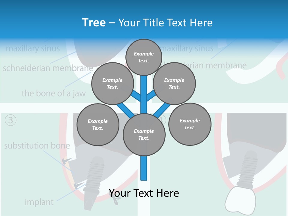 White Dentures Gingiva PowerPoint Template