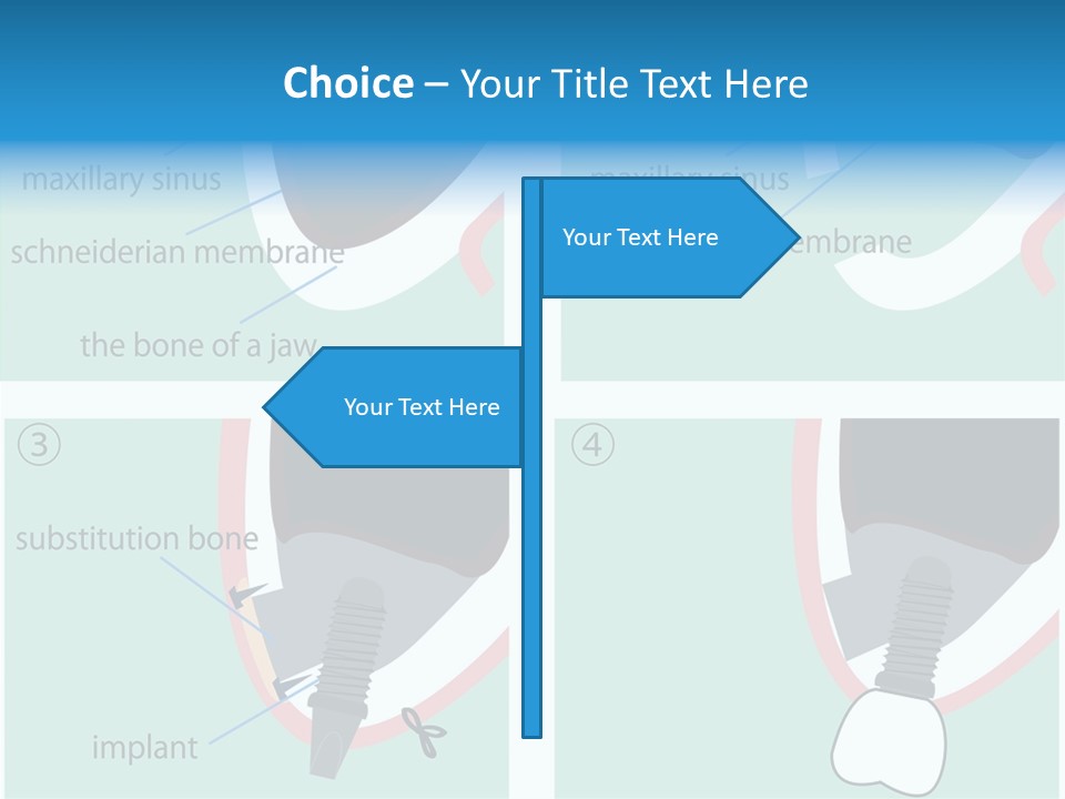 White Dentures Gingiva PowerPoint Template