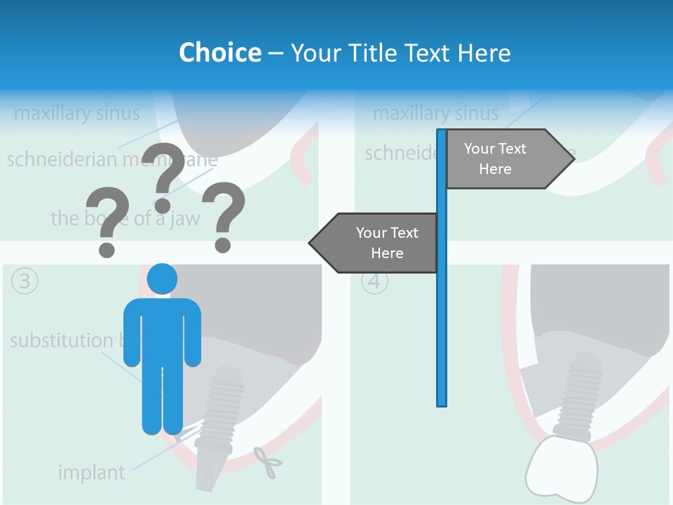 White Dentures Gingiva PowerPoint Template