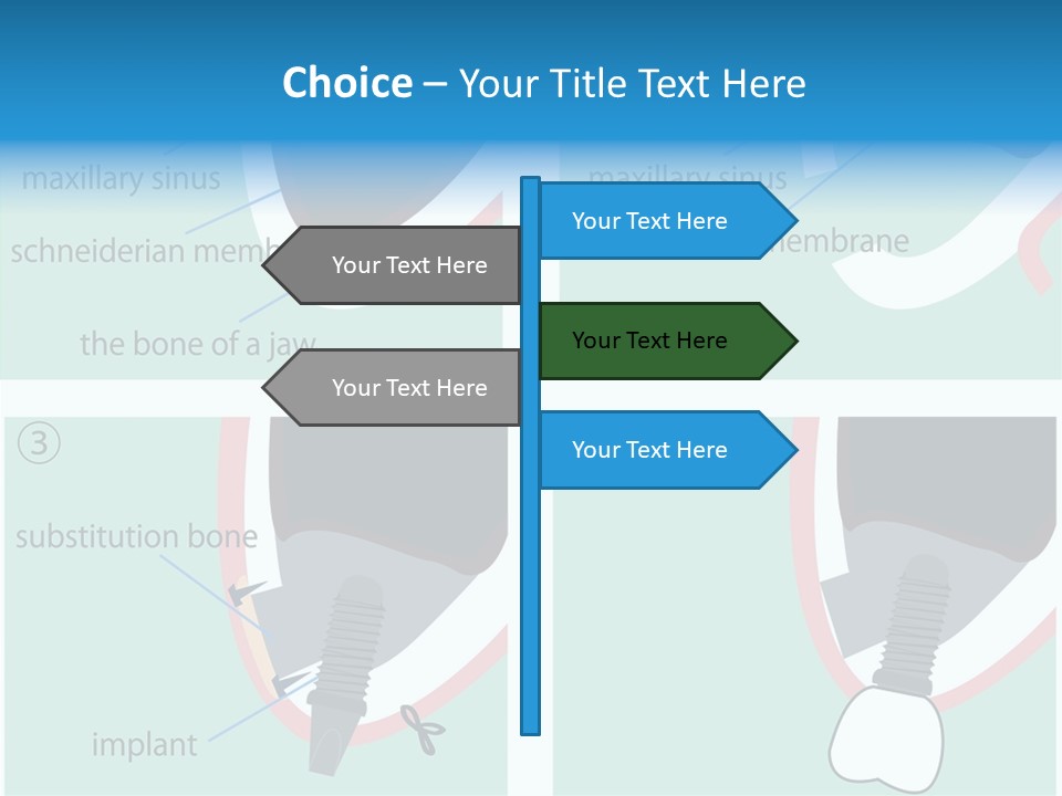 White Dentures Gingiva PowerPoint Template