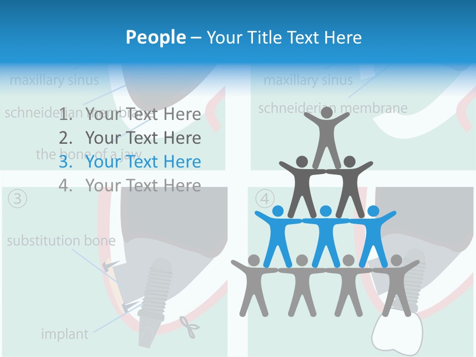 White Dentures Gingiva PowerPoint Template