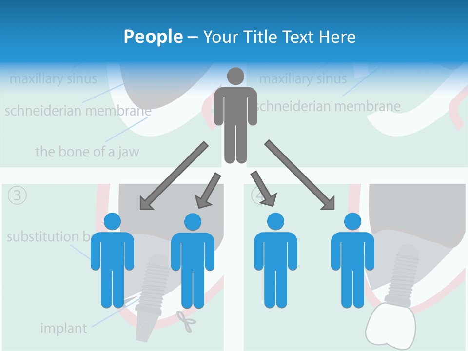 White Dentures Gingiva PowerPoint Template