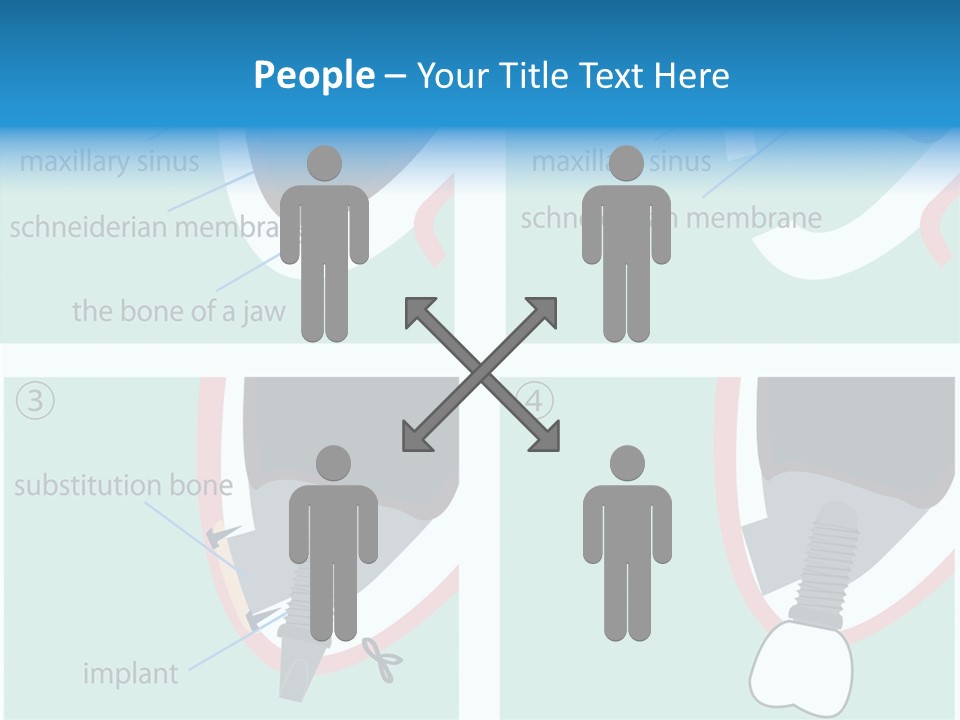 White Dentures Gingiva PowerPoint Template