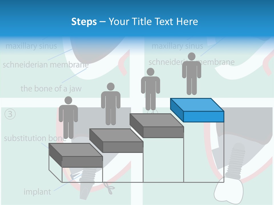 White Dentures Gingiva PowerPoint Template