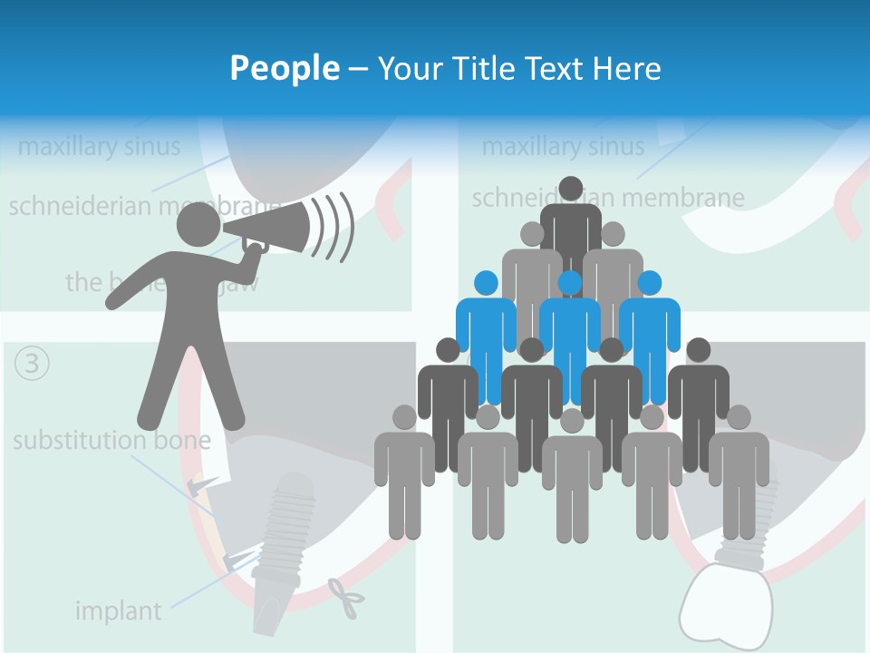 White Dentures Gingiva PowerPoint Template