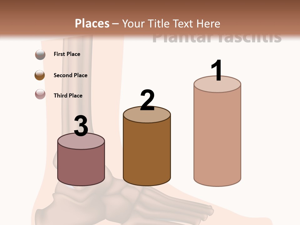 Problem Fibula Ankle PowerPoint Template