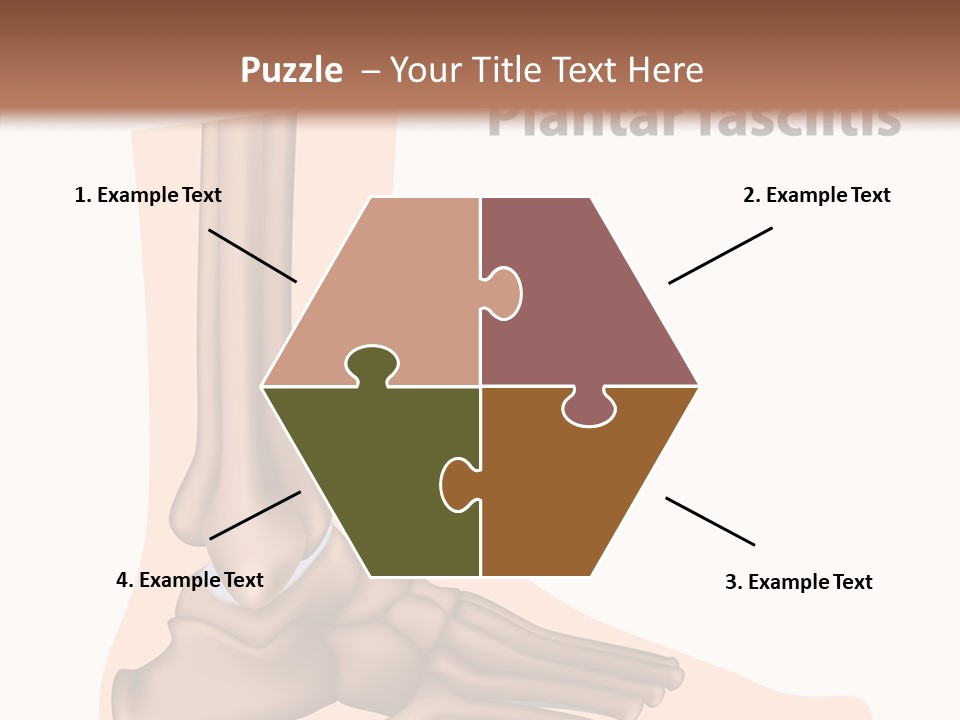 Problem Fibula Ankle PowerPoint Template