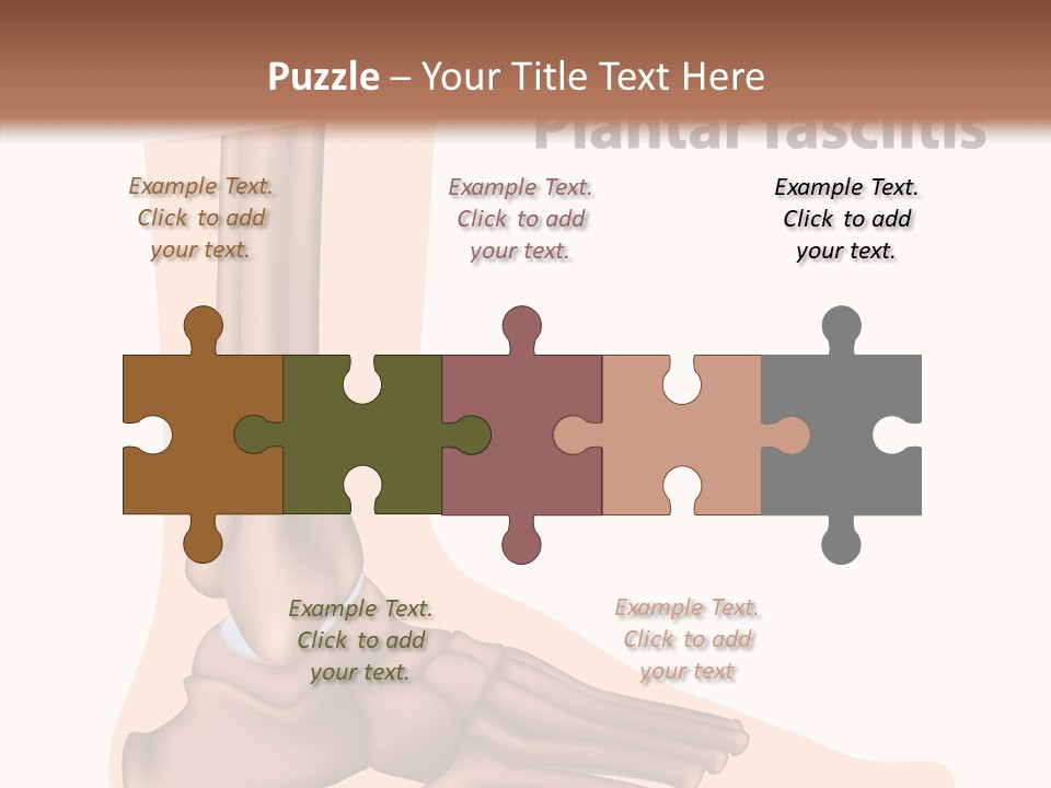 Problem Fibula Ankle PowerPoint Template